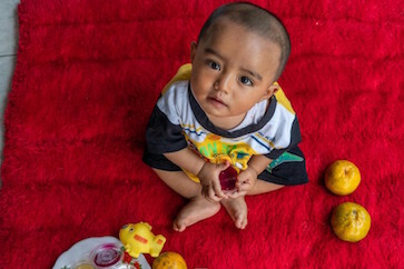 covid-19-worsens-‘double-burden’-of-child-malnutrition-in-indonesia