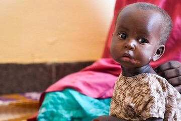 unicef-calls-on-g7-to-help-tackle-global-child-malnutrition-crisis